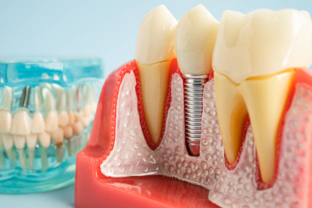 Best Periodontal (Gum) Disease Treatment  in Westway, TX